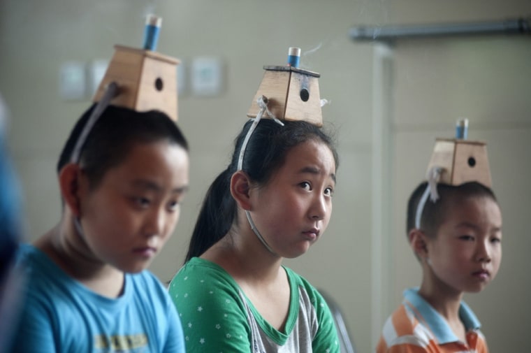 Moxibustion boxes are fixed on children's heads as they receive a traditional Chinese medical treatment as part of a 'Winter Diseases Treated in Summer' event at a hospital in Qingdao, Shandong province on July 18, 2012.