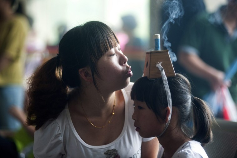 A woman blows on a moxibustion box fixed on her daughter's head in Qingdao on July 18, 2012.