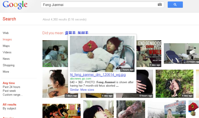 A photo of Feng Jianmei allegedly on her hospital bed after a forced abortion has been circulating on the web. A google image search with her name pulls in this image.