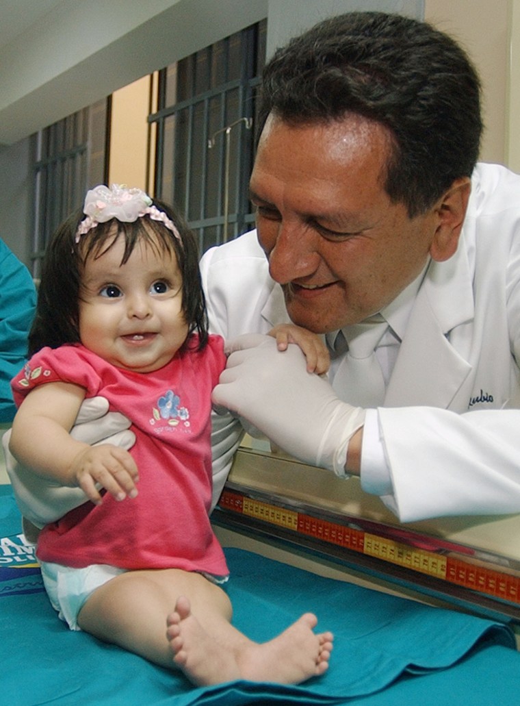 Peruvian doctor Luis Rubio play with baby Milagros Cerron, nine-month-old, in a public hospital in Lima, Peru on Friday, Feb. 4, 2005. Milagros, who looks months younger than her actual age, was born with a rare congenital defect known as sirenomelia, or