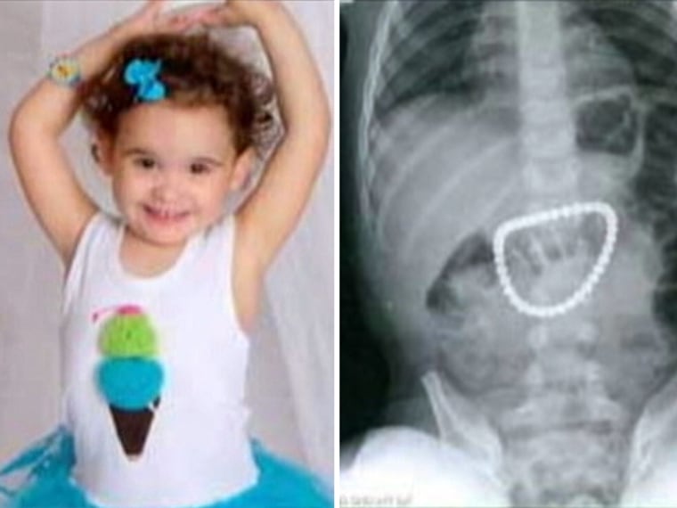 When doctors took an X-ray of Payton Bushnell, 3, they found 37 magnets clustered in her stomach.