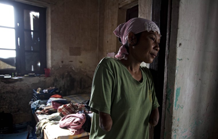 PURWOREJO, INDONESIA - MARCH 13: Armless professional photographer Rusidah, 44, stands inside her house cum studio on March 13, 2012 in Purworejo, Indonesia. Rusidah shoots weddings and parties and has a small studio at home in the village of Botorejo, Bayan District, Purworejo, Central Java where her husband and son also reside. She has been in the photography business for nearly 20 years. (Photo by Ulet Ifansasti/Getty Images)