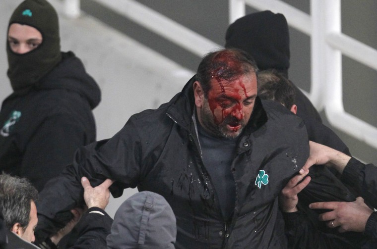 A bleeding Panathinaikos' fan is helped by other fans after being injured during a soccer game for the Greek Super League at the Olympic stadium in Athens, Sunday, March 18 2012. The Greek league game between leader Olympiakos and Panathinaikos has been abandoned with eight minutes to go because of escalating clashes between fans and the police. (AP Photo/Kostas Tsironis)