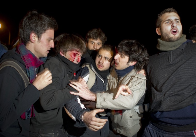 A young man is seen bleeding after being struck by police during a national strike in Madrid on March 29, 2012. Unions have called a national strike to protest the labor reforms, which weaken industry-wide work contracts and make it cheaper to lay off workers.