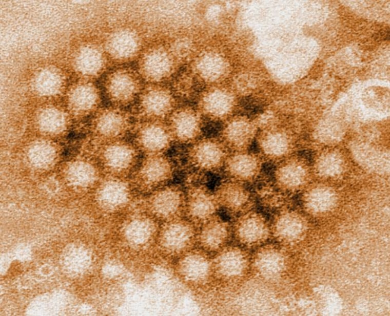 Noroviruses are a group of viruses responsible for some 21 million cases of gastrointestinal illness a year, including 70,000 hospitalizations and 800 deaths.