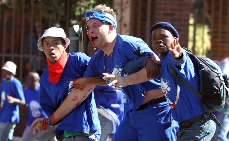 An injured opposition party Democratic Alliance (DA) supporter is helped by fellow members after being hit by a stone during their protest march against the Congress of South African Trade Unions (Cosatu) for opposing the youth wage subsidy in Johannesburg, South Africa on Tuesday May 15. An opposition party march in Johannesburg turned violent Tuesday after union supporters hurled rocks at the leader of South Africa's main opposition party.