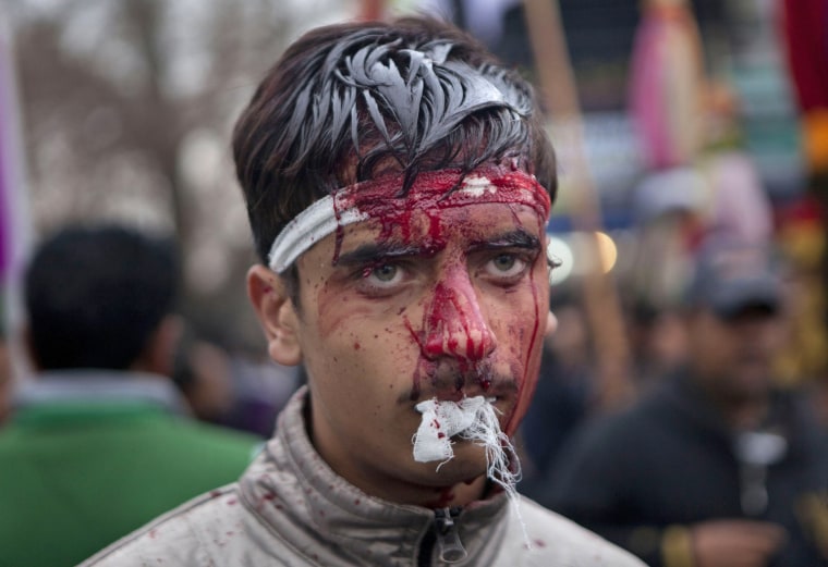Blood runs down the face of a Kashmiri Shiite Muslim as he participates in a procession in Srinagar, India, on Nov. 24.