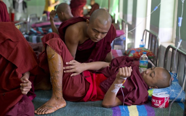 A novice monk who suffered burn injuries points to his wounds as he gets treatment at a hospital in Monywa on Nov. 29, 2012.