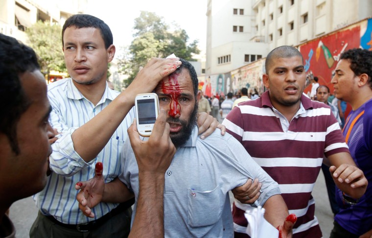 Egyptian Muslim brotherhood protesters take away an injured comrade hit during clashes with opponents of President Mohamed Morsi in Tahrir Square, Cairo, Egypt, on Oct. 12.