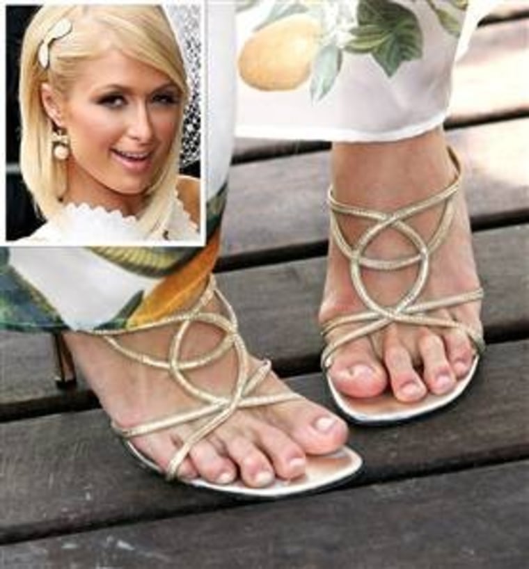 In addition to her big toe being way shorter than her other piggies, Paris Hilton's size 11 feet also appear to have claw toes which look "like bent knees," says Dr. Howard Dinowitz.