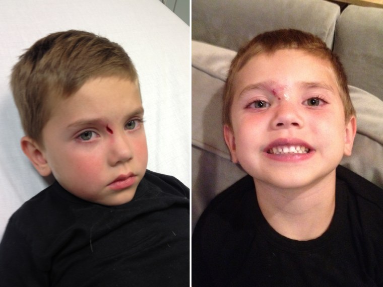 Natalie Morales' 4-year-old son Luke, before and after getting stitches for the first time in September 2012.