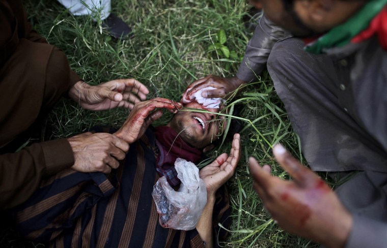A wounded Pakistani protester is helped by others during clashes with riot police that erupted as protestors tried to approach the U.S. embassy, in Islamabad, Pakistan, on Sept. 21.