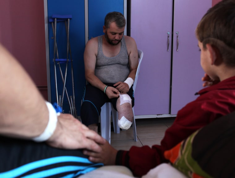 A wounded Syrian refugee shows his injuries after receiving medical treatment at the Reynhali State Hospital, on Sept. 20.