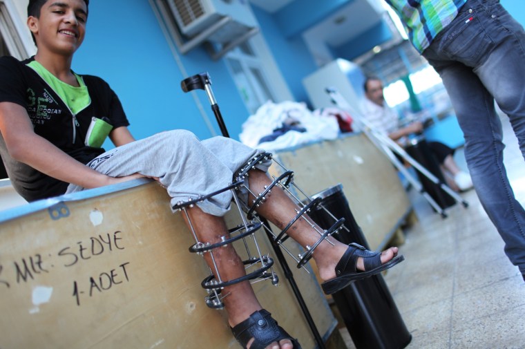 A wounded Syrian refugee shows his injuries after receiving medical treatment at the Reynhali State Hospital, on Sept. 20.