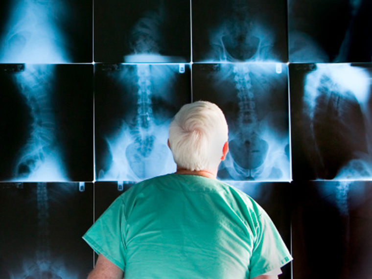 Adding a patient's photo to an X-ray could cut the rate of medical errors caused by mix-up, a new study finds.