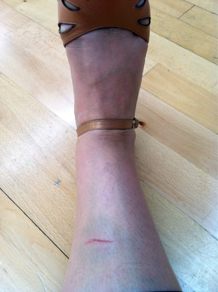 Ricki Lake tweeted a photo of her \"Dancing
 injury.