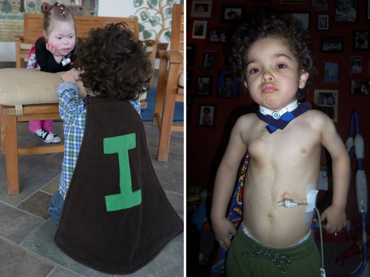 Super Isaac, sporting his Tiny Superheroes cape, was born with an incomplete esophagus, but \"his strength and resilience are unmatched,\" said his mom, Kimberly.