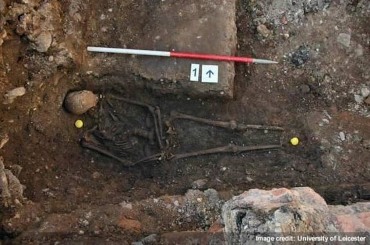 The remains of King Richard III, showing a curved spine and signs of battle trauma.