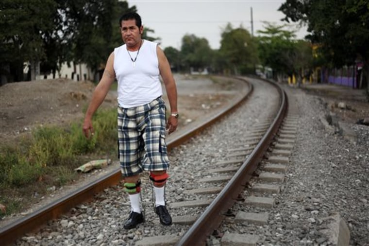 Jose Guadalupe Rodriguez-Saldana, 38, walks with orthopedic supports on the train tracks in the town of Tierra Blanca, Veracruz state, Mexico, on Wednesday March 6. Rodriguez-Saldana and another friend suffered serious injuries during a car accident last May 2008 in northwestern Iowa. After their employers insurance coverage ran out, Rodriguez-Saldana, who was not a legal citizen, was placed on a private airplane and flown to Mexico still comatose and unable to discuss his care or voice his protest. Hospitals confronted with absorbing the cost of caring for uninsured seriously injured immigrants are quietly deporting them, often unconscious and unable to protest, back to their home countries.