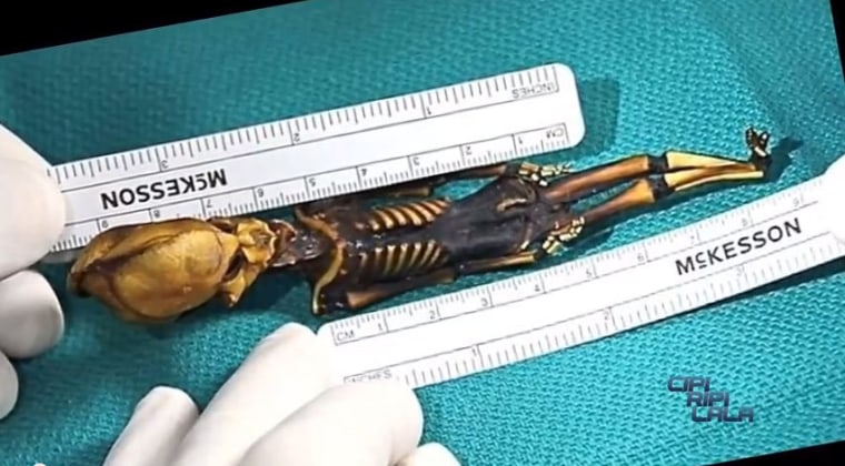 A 6-inch-long (15-centimeter-long) skeleton was found in Chile's Atacama Desert. The skeleton showed several anomalies, including its alienlike skull, teensy body and the fact that it had just 10 ribs rather than the 12 that healthy humans normally have.