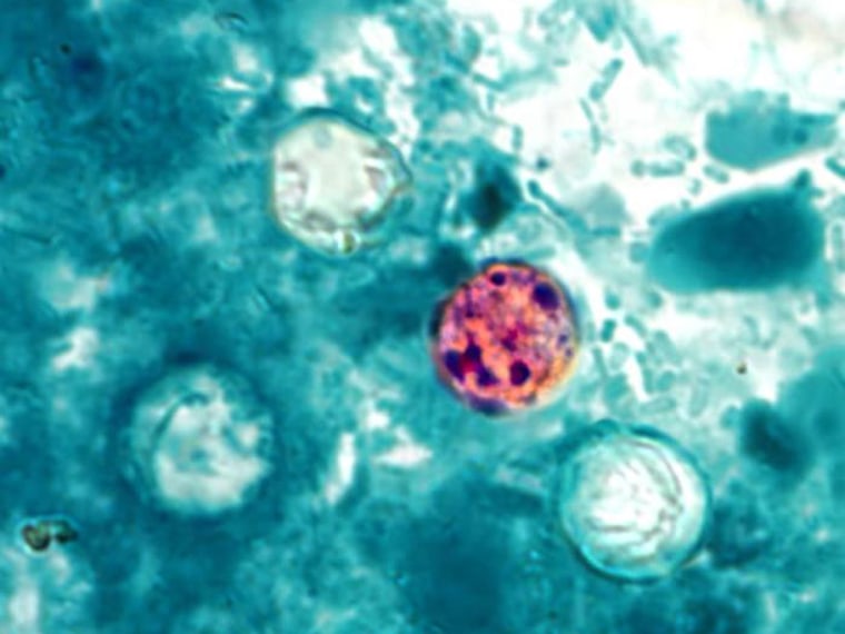 The cyclospora parasite in human stool has made about 250 people sick in the Midwest.