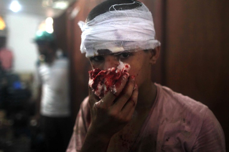 An injured Egyptian youth is seen at a makeshift hospital during clashes between supporters of Egypt's ousted president Mohamed Morsi and police in Cairo on August 14, as security forces backed by bulldozers moved in on two huge pro-Morsi protest camps, launching a long-threatened crackdown that left dozens dead. The clearance operation began shortly after dawn when security forces surrounded the sprawling Rabaa al-Adawiya camp in east Cairo and a similar one at Al-Nahda square, in the centre of the capital.