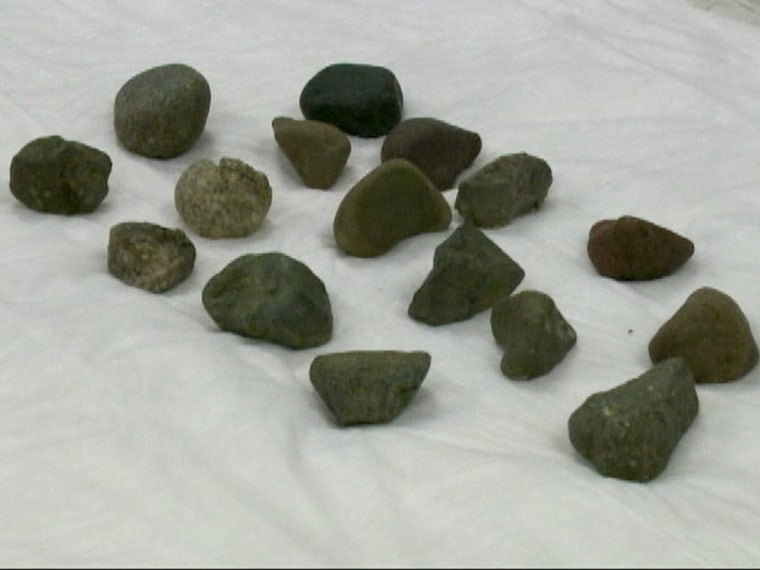 Gordon ate 16 river rocks from his owners' garden. \"We get some wild cases, but the sheer amount is what made this one different,\" a BluePearl spokesperson said.