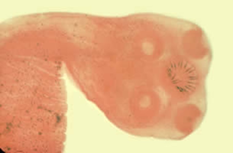 Taenia saginata -- Scoleces of Taenia spp. The scolex of T. solium contains four large suckers and a rostellum containing two rows of large and small ...