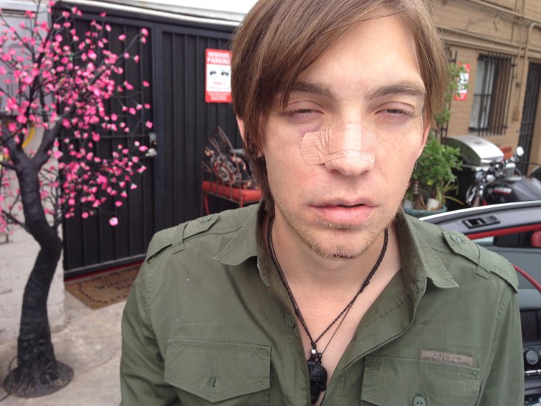 Alex Band after his abduction and beating.