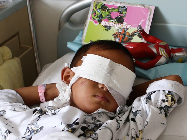 The six-year-old boy, whose eyes were gouged out, lies on a hospital bed in Taiyuan, Shanxi province, Tuesday.