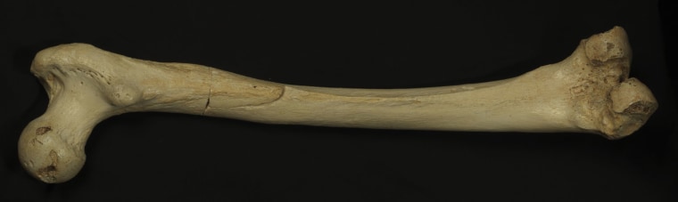 Image: Femur bone