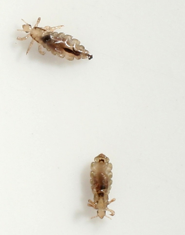 BERLIN - JUNE 22:  Two head lice (Pediculus humanus capitis) crawl on a piece of paper after having been removed from the hair of a little boy June 22...