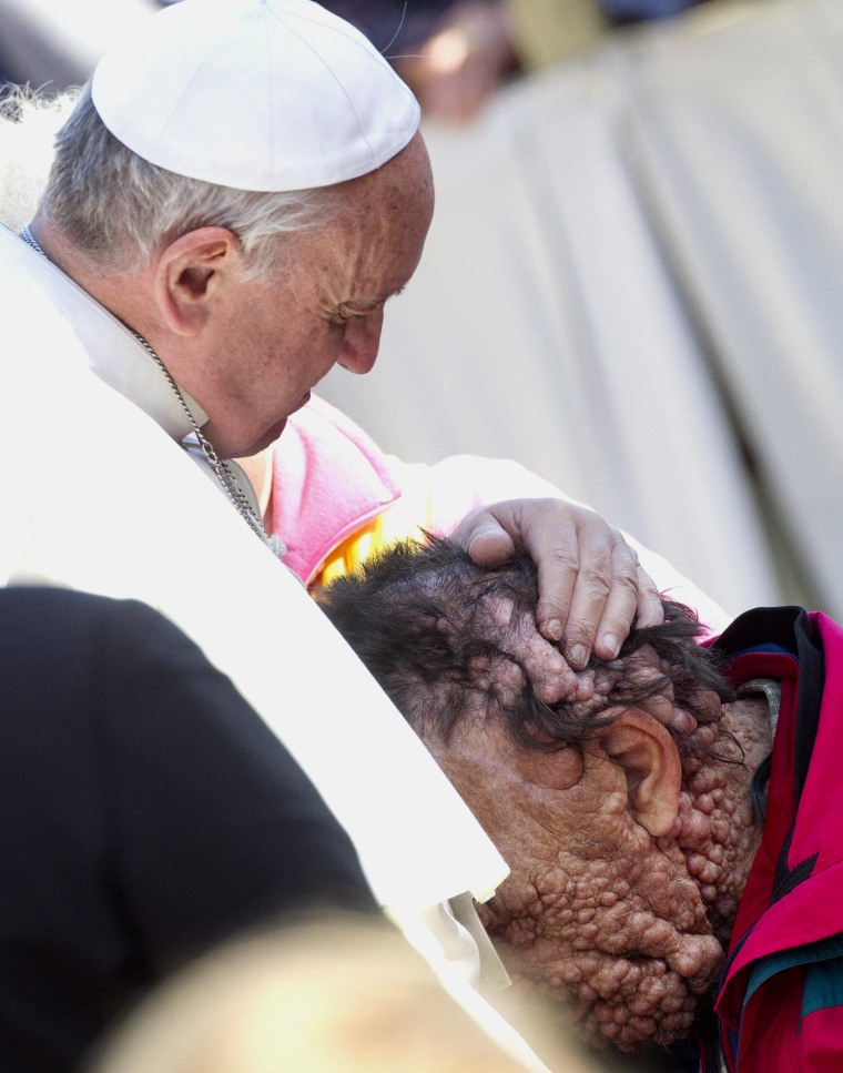 epa03937958 Pope Francis (R) hugs a sick person in Saint Peter's Square at the end of his General Audience in Vatican City, 06 November 2013.  EPA/CLA...