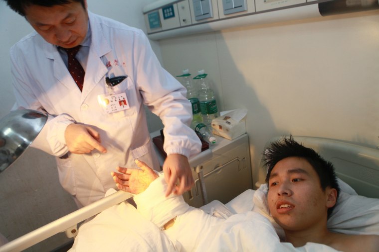 A doctor checking Xiao Wei's hand on Dec. 10, after it was reattached to his arm.