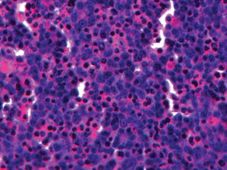 Researchers at Organovo now use bioprinting to keep human liver tissue samples like the one pictured above in a cross-section functioning for 40 days.