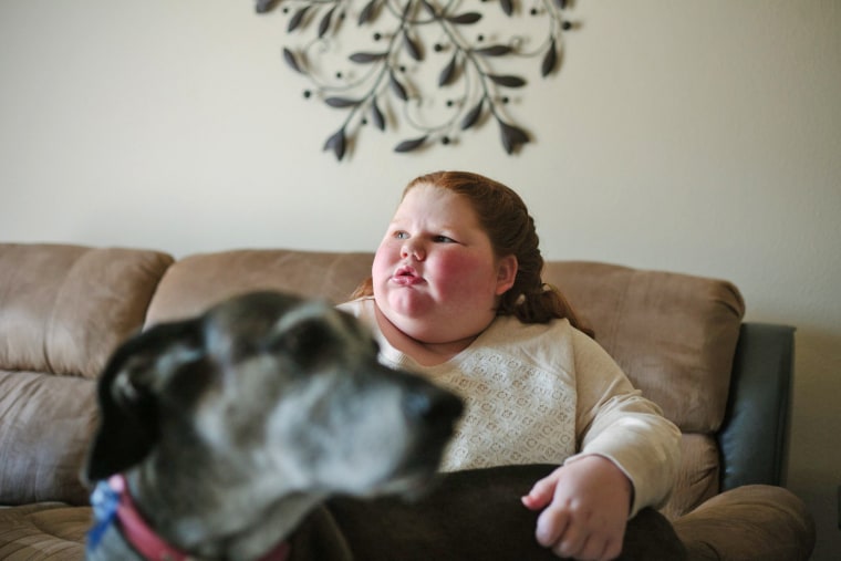 Cibolo, Tx., December 11. 2013: Alexis Shapiro, 12, had a brain tumor removed three years ago, when she was a normal-sized 9-year-old. Ever since the ...