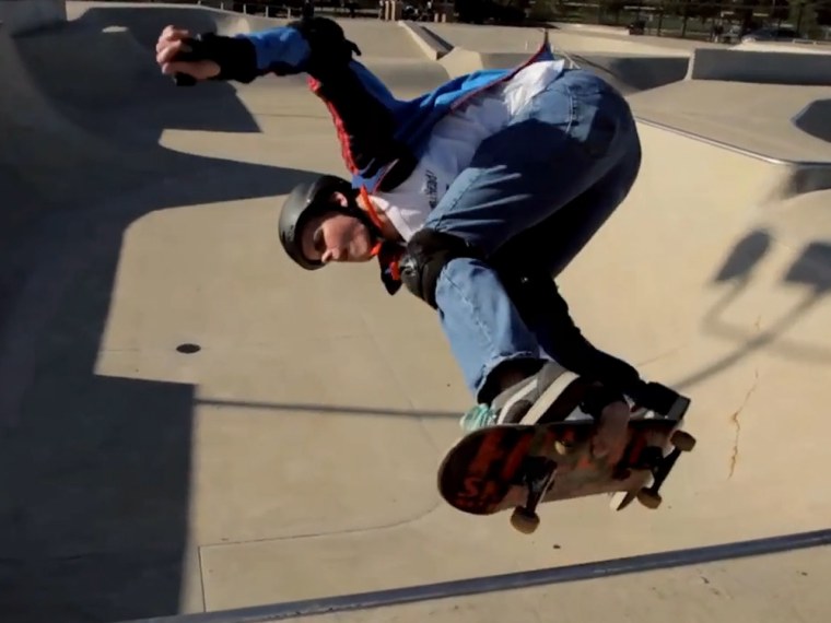 Skateboarder Tommy Carroll lost his sight when he was two years old.