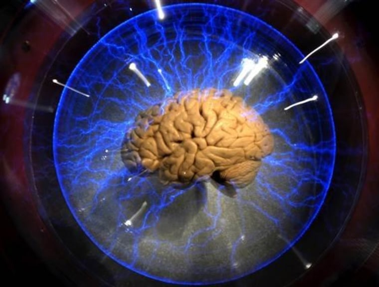 An actual human brain is displayed inside a glass box as part of an interactive exhbition titled