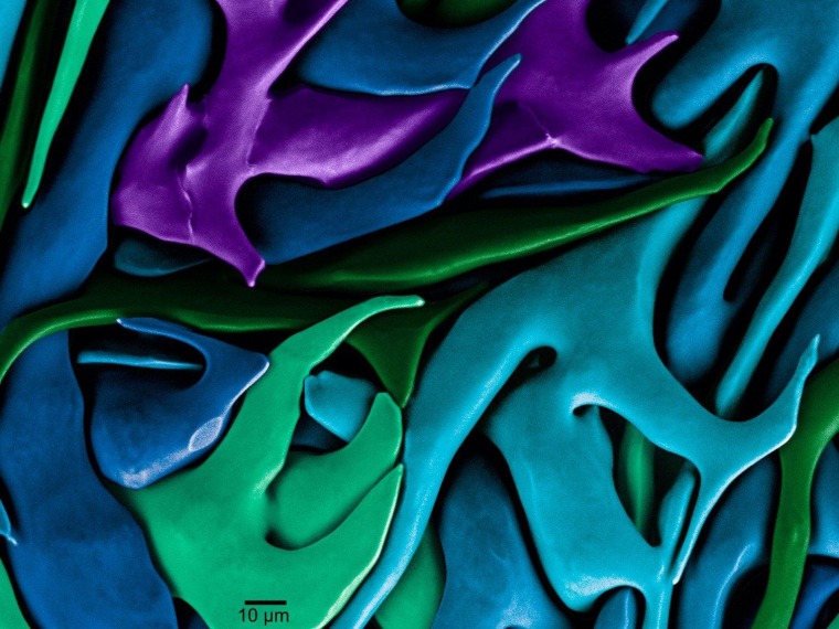 \"Biomineral Single Crystals\" is the first-place winner as well as the People's Choice in the photography category of the 2012 International Science and Engineering Visualization Challenge. These biomineral crystals are found in a sea urchin's tooth, and captured here using environmental scanning electron microscopy. Each color highlights a single crystal of calcite, making the tooth tough enough to grind rock.