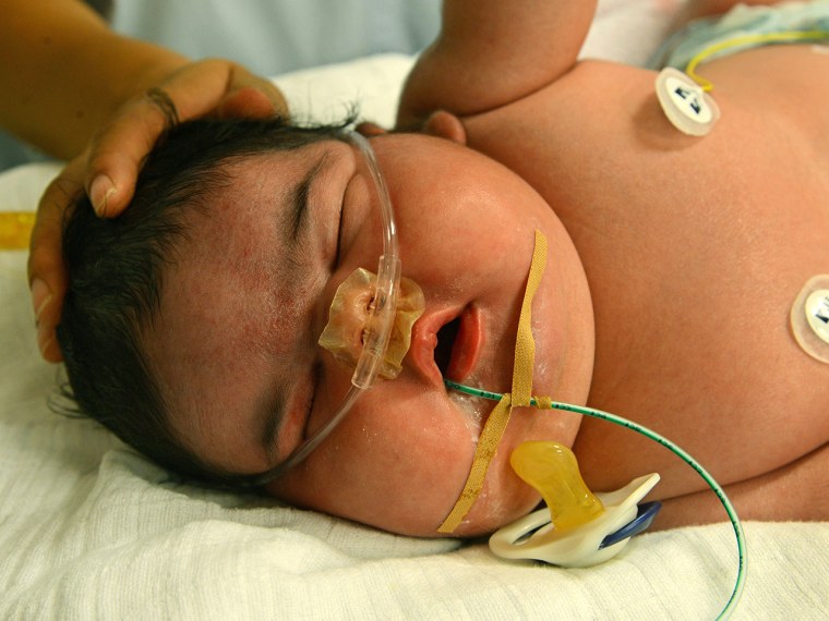 Germany's heaviest newborn, baby girl Jasleen, is in the neonatal intensive care ward of the University Hospital in Leipzig, Germany.
