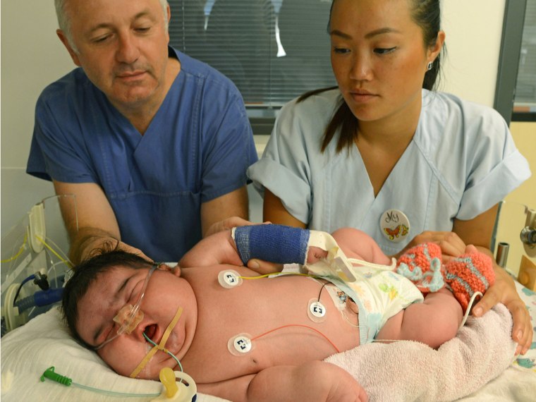 Consultant physician Matthias Knuepfer and nurse My take care of Germany's heaviest newborn until now at the neonatal intensive care ward of the Unive...