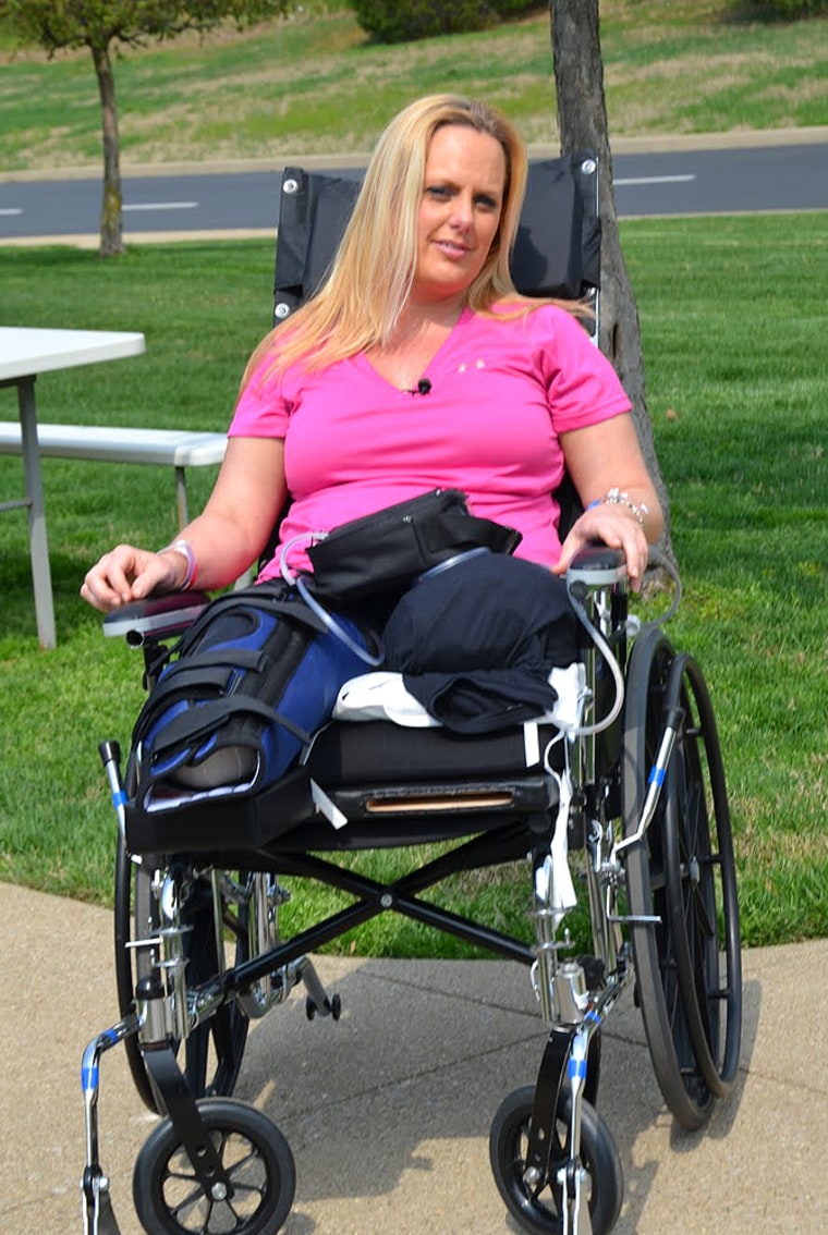 Stephanie Decker, seen here in rehabilitation on March 20, 2012, says she never experienced post-traumatic stress after losing her legs in a tornado.
