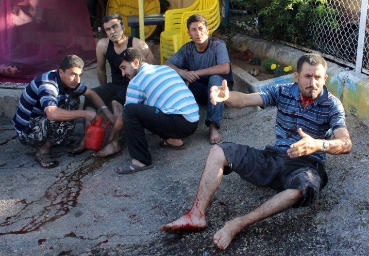 A wounded man awaits medical attention after two rockets allegedly launched by Syrian rebels hit houses and cars in a southern suburb of Beirut, Lebanon on May 26, 2013.