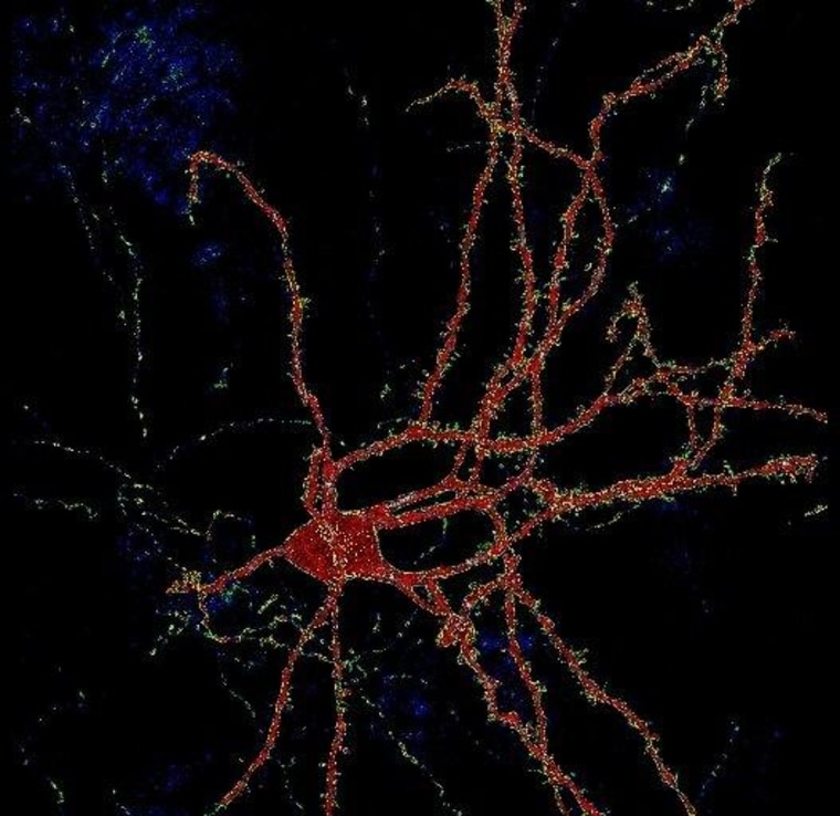 A medium spiny neuron with extensive dendrites, or projections that enable it to communicate with other brain cells.