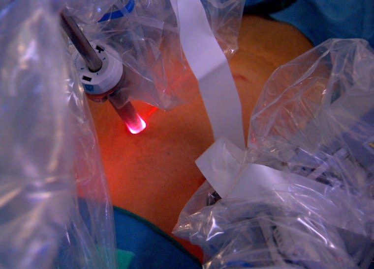 A patient undergoes robotic surgery.