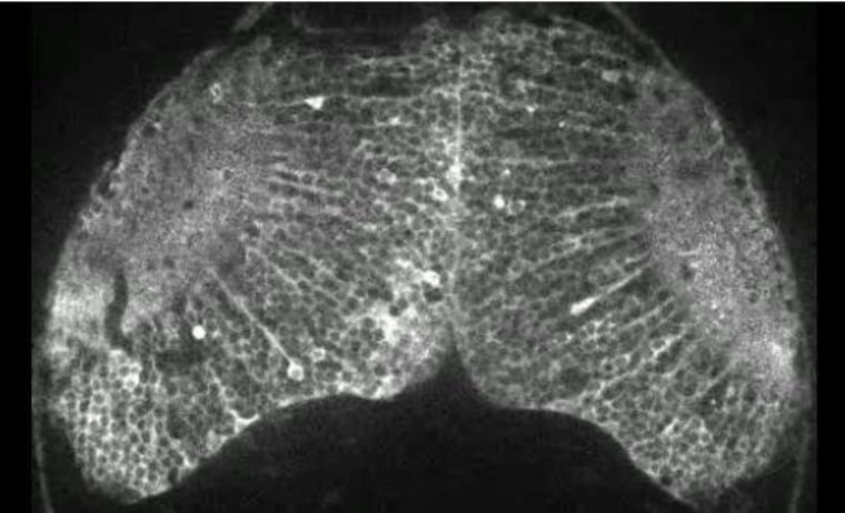 Researchers developed a way to follow neural signals in the brain of a zebrafish larva, using a sensitive fluorescent marker.