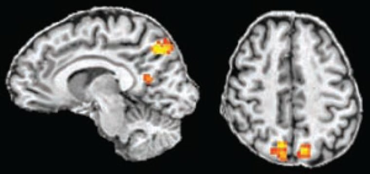 How your brain picks the best move