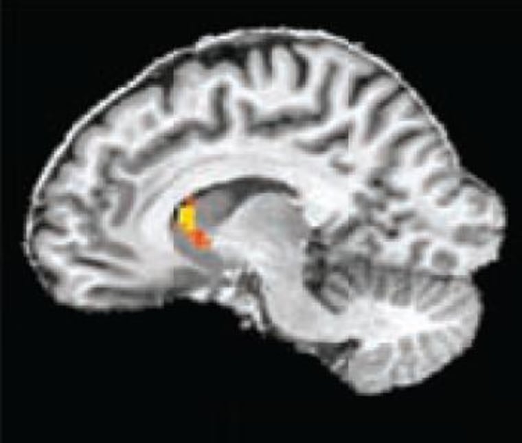 How your brain picks the best move