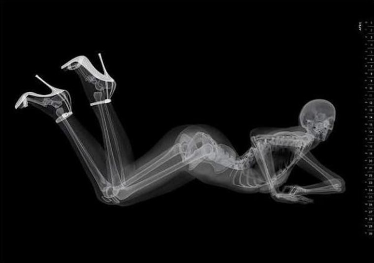 "Miss September" wears stiletto heels as she strikes a pose for the Eizo X-ray pinup calendar.