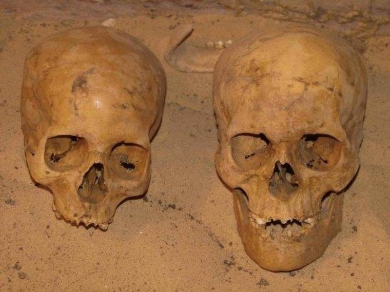 Two skulls excavated from the Qubbet el-Hawa necropolis in Egypt.
